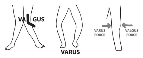 what direction is valgus force